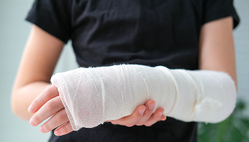 Broken Bones